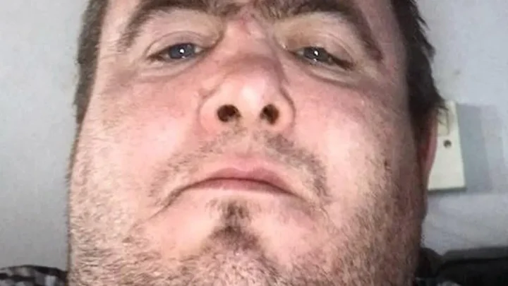 Belfast victim was drugged and set on fire in previous attack